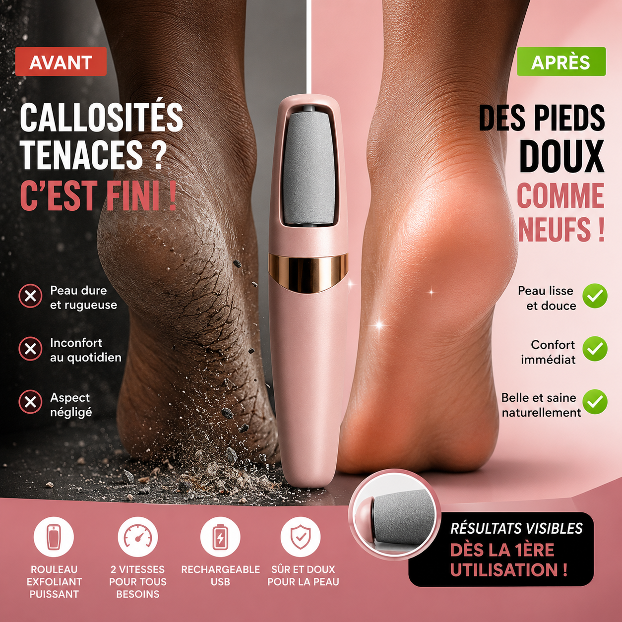 Pieds Neufs en 1 Minute