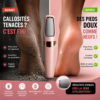 Pieds Neufs en 1 Minute