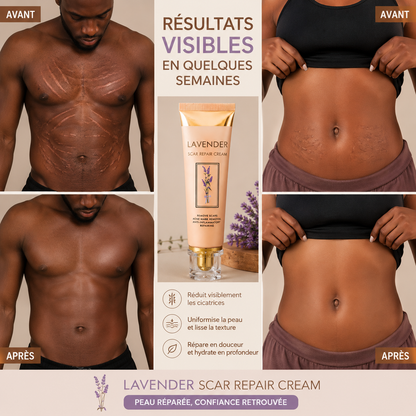 Yoxier Crème anti-cicatrice et Imperfections